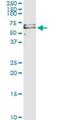 Perforin-1 antibody, H00005551-M04, Novus Biologicals, Immunoprecipitation image 