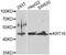 Keratin 16 antibody, A7493, ABclonal Technology, Western Blot image 