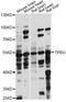 Trophoblast Glycoprotein antibody, LS-C749772, Lifespan Biosciences, Western Blot image 
