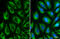 Citrate Synthase antibody, GTX110624, GeneTex, Immunofluorescence image 