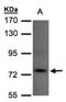 Tousled Like Kinase 1 antibody, NBP1-32354, Novus Biologicals, Western Blot image 