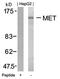 c-met antibody, orb14618, Biorbyt, Western Blot image 