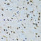 Insulin Like Growth Factor 1 antibody, LS-C330912, Lifespan Biosciences, Immunohistochemistry paraffin image 