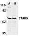 Neural Cell Adhesion Molecule 2 antibody, orb19241, Biorbyt, Western Blot image 