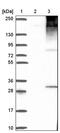 Elongation of very long chain fatty acids protein 3 antibody, PA5-57577, Invitrogen Antibodies, Western Blot image 