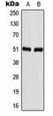 Gamma-Aminobutyric Acid Type A Receptor Alpha1 Subunit antibody, orb216112, Biorbyt, Western Blot image 
