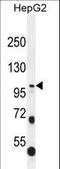 Collagen Type XXI Alpha 1 Chain antibody, LS-C166924, Lifespan Biosciences, Western Blot image 