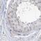 Myotilin antibody, NBP1-87851, Novus Biologicals, Immunohistochemistry paraffin image 