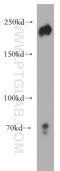 Zinc finger E-box-binding homeobox 1 antibody, 21544-1-AP, Proteintech Group, Western Blot image 