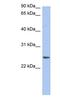 Neurensin 2 antibody, NBP1-59831, Novus Biologicals, Western Blot image 