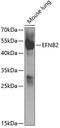 Ephrin B2 antibody, A5669, ABclonal Technology, Western Blot image 