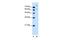 Solute Carrier Family 26 Member 1 antibody, GTX46796, GeneTex, Western Blot image 