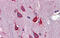 T-Box 5 antibody, ARP33403_P050, Aviva Systems Biology, Immunohistochemistry frozen image 