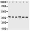 Cyclin Dependent Kinase 7 antibody, PA2126-2, Boster Biological Technology, Western Blot image 