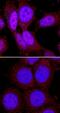 Ribosomal Protein S6 Kinase B1 antibody, MAB8963, R&D Systems, Immunocytochemistry image 