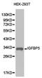 Insulin Like Growth Factor Binding Protein 5 antibody, LS-C192802, Lifespan Biosciences, Western Blot image 