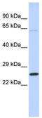 ATP Synthase Peripheral Stalk-Membrane Subunit B antibody, TA346561, Origene, Western Blot image 