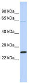 ATP synthase subunit b, mitochondrial antibody, TA346561, Origene, Western Blot image 