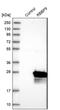 RB Binding Protein 9, Serine Hydrolase antibody, PA5-53389, Invitrogen Antibodies, Western Blot image 