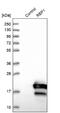 CRBP1 antibody, NBP2-33862, Novus Biologicals, Western Blot image 