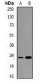 UL16 Binding Protein 2 antibody, abx142298, Abbexa, Western Blot image 