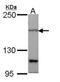 PTCH1 antibody, NBP2-19705, Novus Biologicals, Western Blot image 