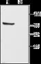 Potassium Voltage-Gated Channel Subfamily C Member 1 antibody, GTX16641, GeneTex, Western Blot image 