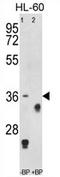 TNF Receptor Superfamily Member 14 antibody, AP54309PU-N, Origene, Western Blot image 