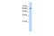 Zic Family Member 2 antibody, GTX50893, GeneTex, Western Blot image 