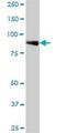 Procollagen-Lysine,2-Oxoglutarate 5-Dioxygenase 2 antibody, H00005352-B01P, Novus Biologicals, Western Blot image 