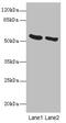 Patatin Like Phospholipase Domain Containing 2 antibody, CSB-PA836180LA01HU, Cusabio, Western Blot image 