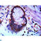 Suppressor Of Cytokine Signaling 3 antibody, LS-C813125, Lifespan Biosciences, Immunohistochemistry paraffin image 