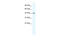 T-Box 6 antibody, 27-853, ProSci, Western Blot image 