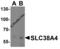 Sodium-coupled neutral amino acid transporter 4 antibody, 8343, ProSci Inc, Western Blot image 