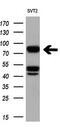 B-Raf Proto-Oncogene, Serine/Threonine Kinase antibody, GTX84807, GeneTex, Western Blot image 
