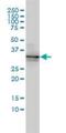 BMP And Activin Membrane Bound Inhibitor antibody, H00025805-M01, Novus Biologicals, Western Blot image 