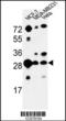 Proteasome Subunit Alpha 5 antibody, LS-C162221, Lifespan Biosciences, Western Blot image 