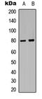 G Protein-Coupled Receptor Kinase 2 antibody, LS-C358898, Lifespan Biosciences, Western Blot image 