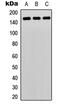 Phospholipase C Gamma 2 antibody, abx121555, Abbexa, Western Blot image 