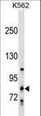 Collagen Beta(1-O)Galactosyltransferase 2 antibody, LS-C159741, Lifespan Biosciences, Western Blot image 