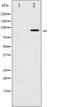 Aryl Hydrocarbon Receptor antibody, abx011630, Abbexa, Western Blot image 