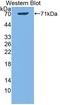 Dipeptidyl Peptidase 9 antibody, LS-C695766, Lifespan Biosciences, Western Blot image 