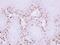 Melanoma-associated antigen 11 antibody, PA5-22114, Invitrogen Antibodies, Immunohistochemistry frozen image 