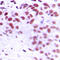 Mesenchyme Homeobox 2 antibody, GTX55157, GeneTex, Immunohistochemistry paraffin image 