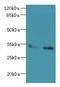 Solute Carrier Family 25 Member 36 antibody, LS-C378980, Lifespan Biosciences, Western Blot image 