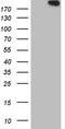 CDC42 Binding Protein Kinase Alpha antibody, TA808223, Origene, Western Blot image 