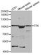 TTK Protein Kinase antibody, MBS128640, MyBioSource, Western Blot image 