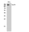 Nucleoporin 160 antibody, A05629, Boster Biological Technology, Western Blot image 