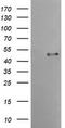 Transmembrane Serine Protease 5 antibody, LS-C337643, Lifespan Biosciences, Western Blot image 