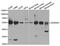 Aldehyde Dehydrogenase 3 Family Member A1 antibody, STJ27453, St John